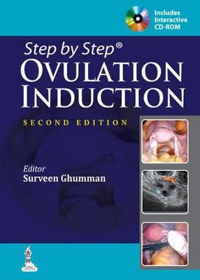 Ovulation Induction
