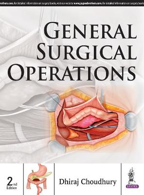 General Surgical Operations