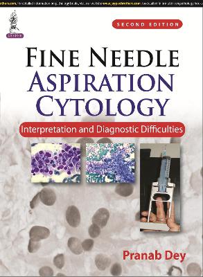 Fine Needle Aspiration Cytology: Interpretation and Diagnostic Difficulties