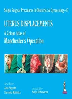 Single Surgical Procedures in Obstetrics and Gynaecology - 17 - UTERUS DISPLACEMENTS