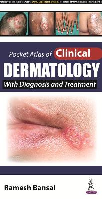 Pocket Atlas of Clinical Dermatology