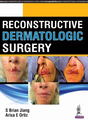 Reconstructive Dermatologic Surgery