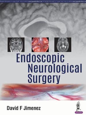 Endoscopic Neurological Surgery
