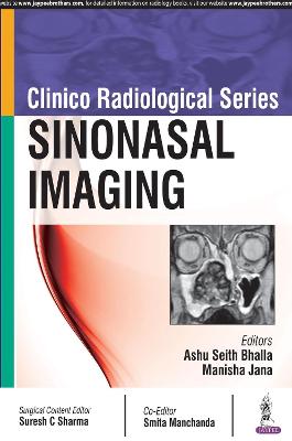 Clinico Radiological Series: Sinonasal Imaging