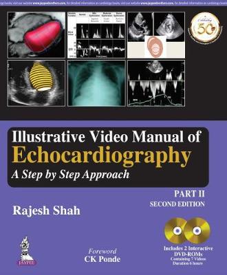 Illustrative Video Manual of Echocardiography