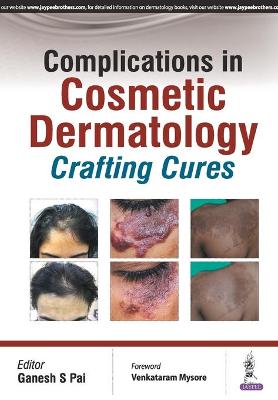 Complications in Cosmetic Dermatology