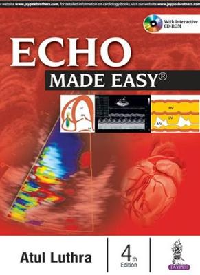 Echo Made Easy