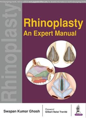 Rhinoplasty