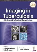 Imaging in Tuberculosis