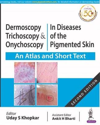 Dermoscopy, Trichoscopy and Onychoscopy in Diseases of the Pigmented Skin