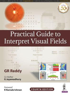 Practical Guide to Interpret Visual Fields