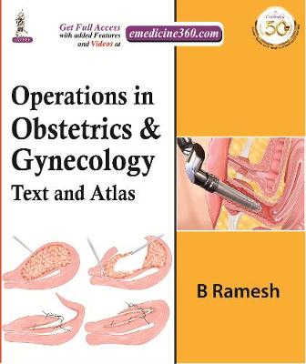 Operations in Obstetrics & Gynecology